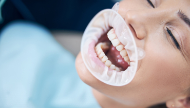 La sonrisa, tu mejor carta de presentación.