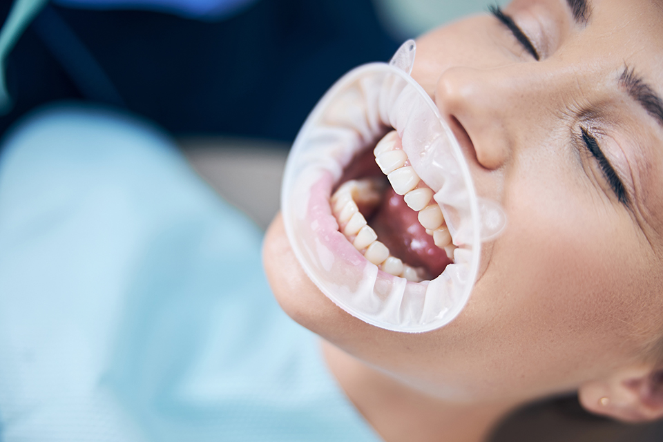 La sonrisa, tu mejor carta de presentación.